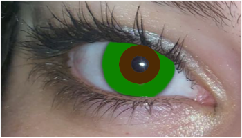  - (Augen, Augenfarbe, Augenarzt)