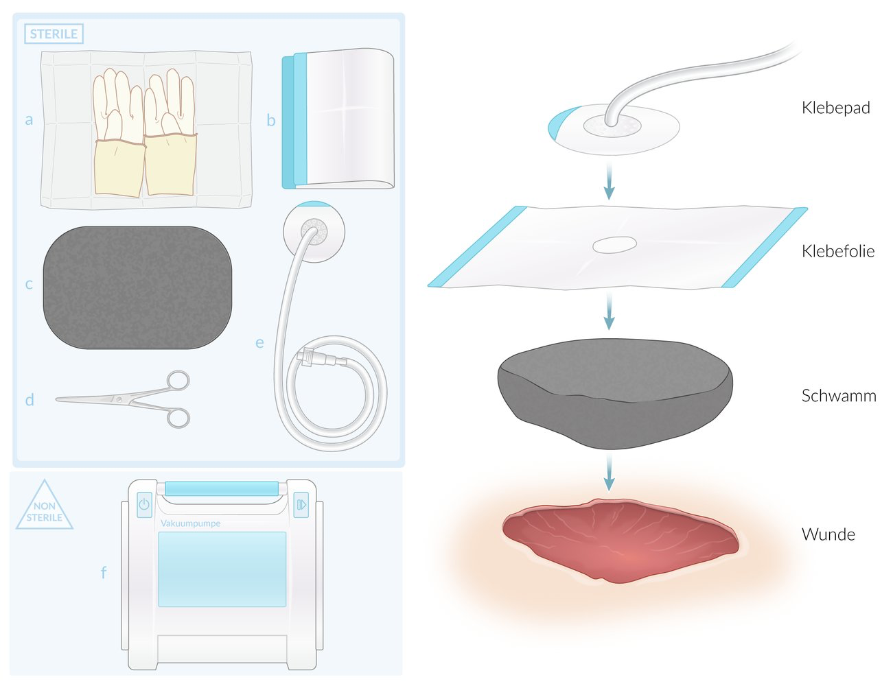 VacPumpe Spezielle Pflege? (Gesundheit und Medizin, Krankenhaus
