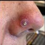 - (Piercing, Nasenpiercing, Wildfleisch)