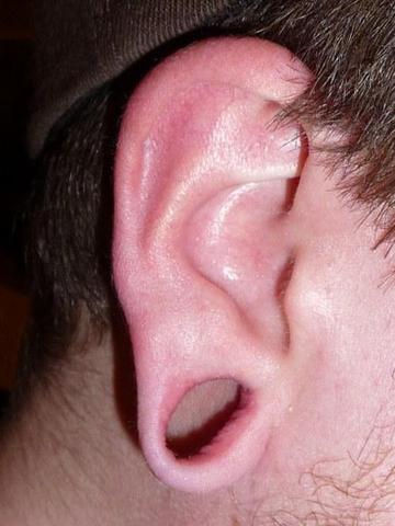 Ohrloch ausgeleiert durch Ohrtunnel - (Piercing, Ohr, Schmuck)