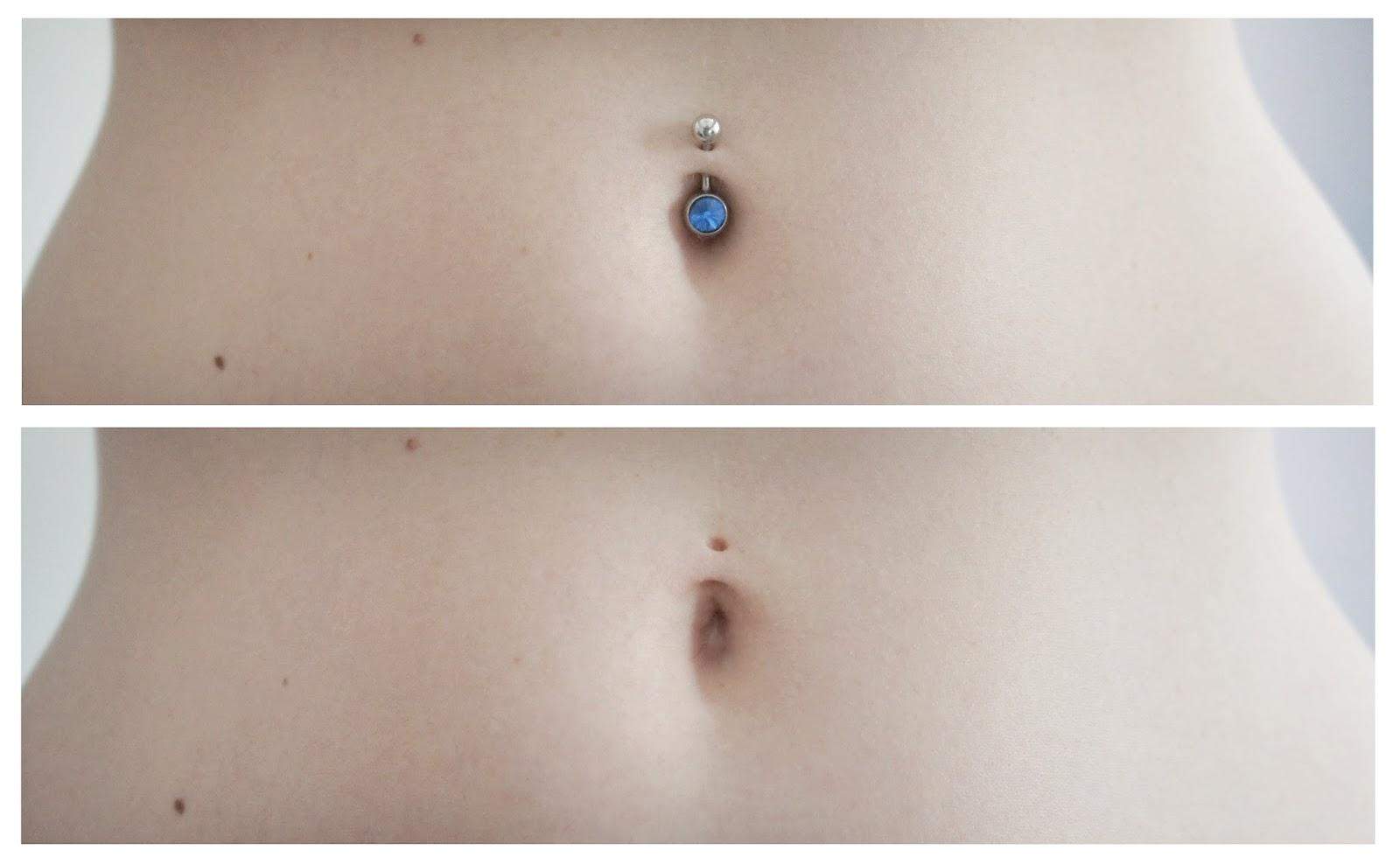 Frisches Bauchnabelpiercing zuwachsen? (Gesundheit und Medizin, Haut