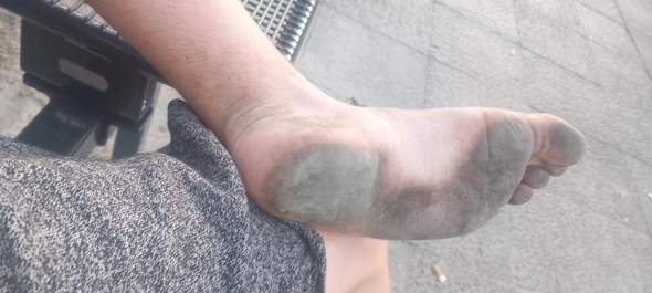 - (Schuhe, barfuß, dreckige Fußsohlen)