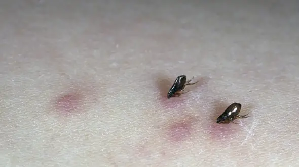 - (Parasiten, Flöhe)