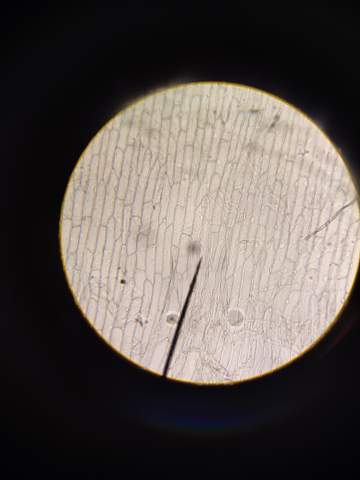 Pflanzenzelle und Tierzelle? (Zelle)