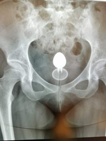 anal plug verschwunden Baby Jesus Butt Plug main image 1