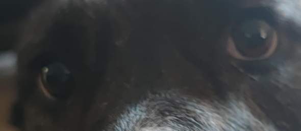 Plötzlich Eine Pupille Größer Als Die Andere
