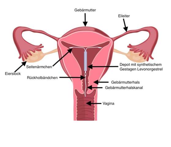 - (Mädchen, Gesundheit, Sex)