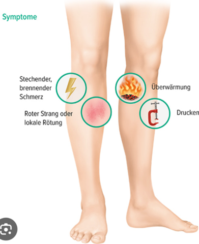 Bild zum Beitrag