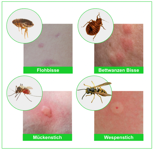 Sind Das Fl he Insekten Sch dlinge Ungeziefer sind-das-fl-he-insekten-sch-dlinge-ungeziefer