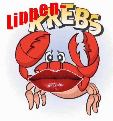Lippenkrebs - (Medizin, Krebs)