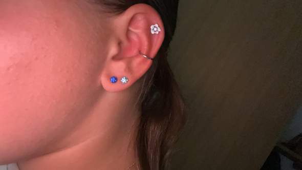 - (Schmerzen, Piercing, Entzündung)