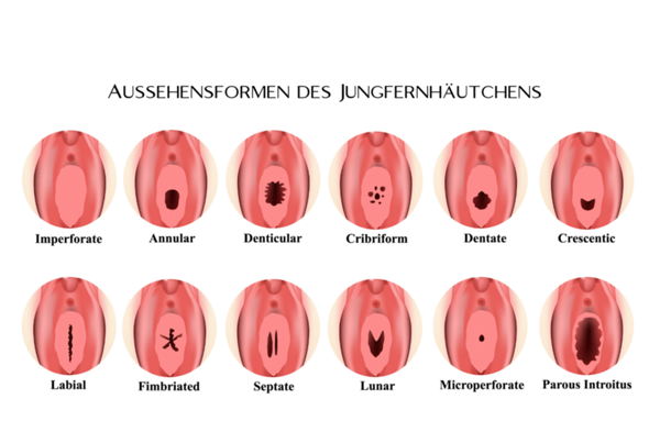 Bild zum Beitrag