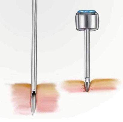 - (Schmerzen, Piercing, Entzündung)