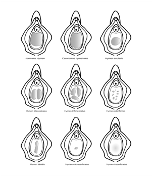 - (Selbstbefriedigung, masturbieren, Vagina)