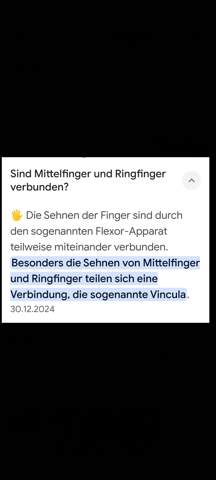 - (Menschen, Hand, Anatomie)