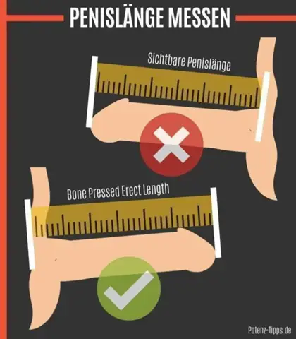- (Jungs, Sexualität, Penis)