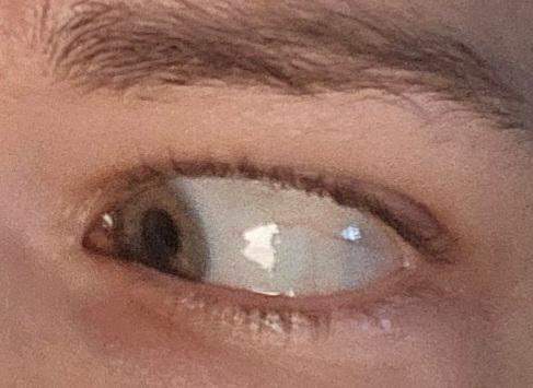 - (Gesundheit, Menschen, Medizin)