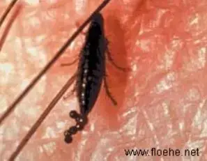 - (Parasiten, Flöhe)