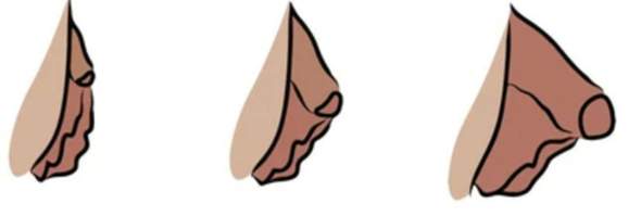 - (Vagina, Gynäkologe)