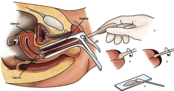 - (Schmerzen, Periode, Vagina)