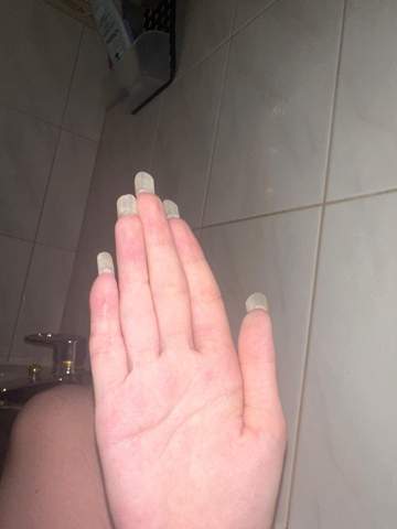 - (Mädchen, Nägel, Fingernägel)