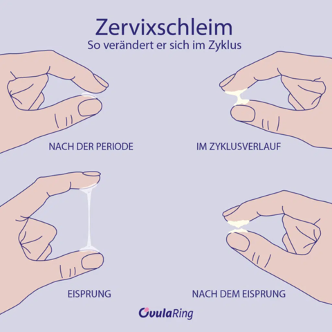 - (Vagina, Entzündung, Mädchenprobleme)