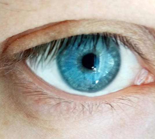 - (Augen, Gesicht, Augenfarbe)