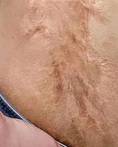 - (Aussehen, braun-werden, Sonnenbaden)