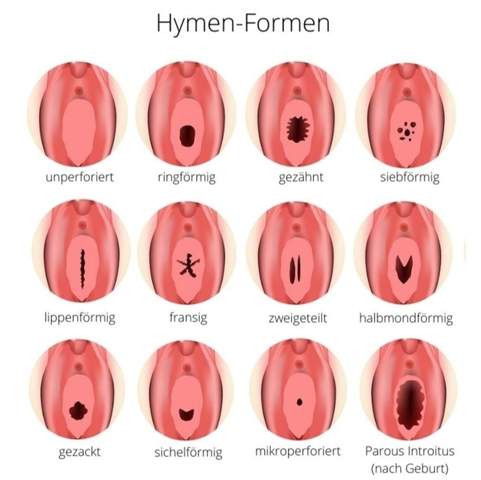 - (Schmerzen, Vagina, Gynäkologe)