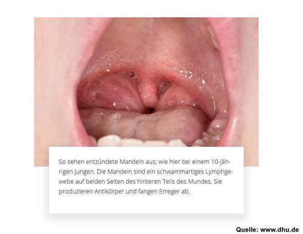Bild zum Beitrag