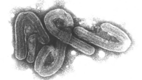 - (Krankheit, Virus, Kopfschmerzen)