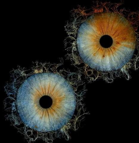 - (Augen, Augenfarbe, Seltenheit)