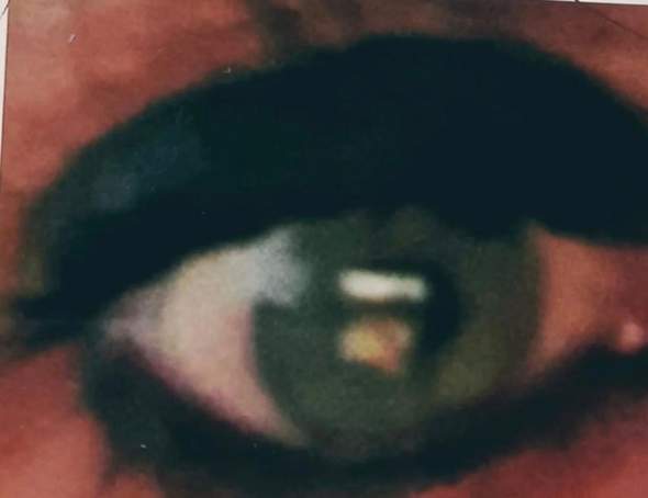 - (Augen, Augenfarbe)