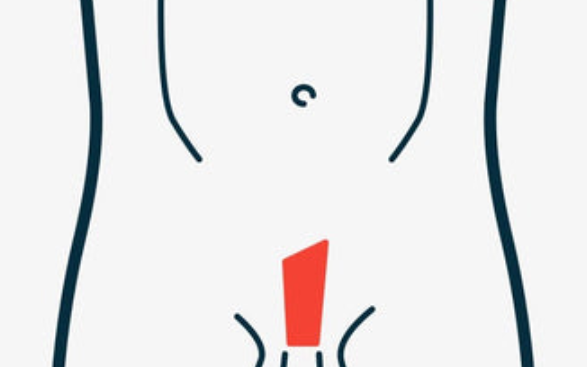 - (Sexualität, Intimbereich)
