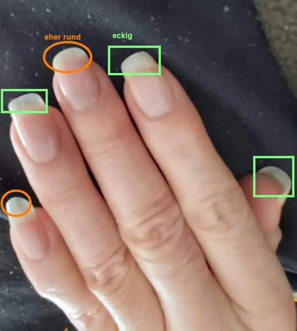 - (Nägel, Fingernägel, Nagelpflege)