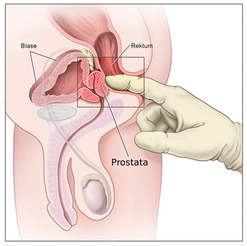 Wie kann man anal sb machen? (Sexualitt, Selbstbefriedigung, Penis) Wie kann man anal sb machen? (Sexualitt, Selbstbefriedigung, Penis)