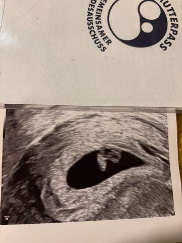- (Baby, Ultraschall)