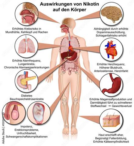 Bild zum Beitrag
