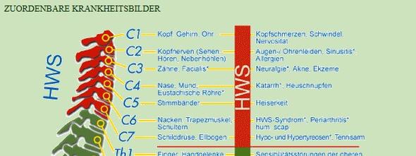 Kann durch die HWS (1ster Wirbel) ein Schwankschwindel ausgelößt werden ...
