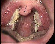 - (Gesundheit, Medizin, Krankheit)