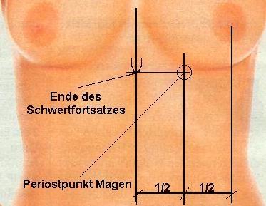 - (Sodbrennen, Homeopatie)