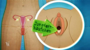 Jungfernhautchen Gerissen Aussehen