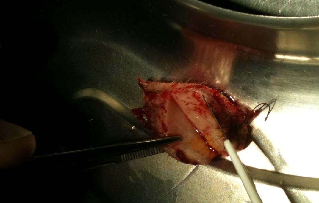 Ich hab seit ca. 1 Jahr am Kopf, unter der Kopfhaut ein Knubbel, was