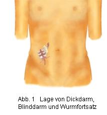 Auf Welcher Seite Ist Der Blinddarm Von Mir Aus Gesehen Bio Auf Welcher Seite Ist Der Blinddarm Von Mir Aus Gesehen Bio