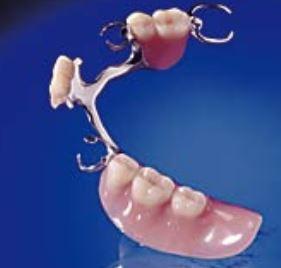 Bild 1 - (Zähne, Zahnarzt, Zahnmedizin)