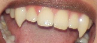 Vampirzahne Zum Aufstecken Vampire Fasching