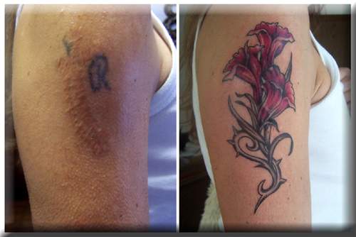 Narben vom Ritzen lassen oder ein Tattoo drüber
