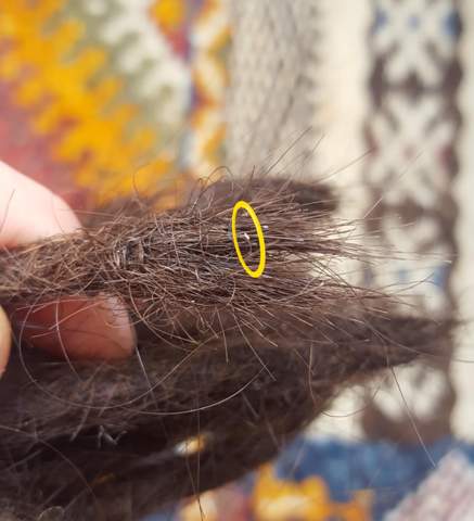 dreads und lause gesundheit und