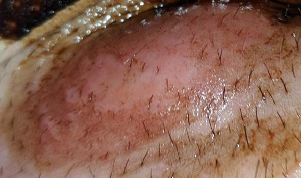 zugsalbe schmerzt gesundheit und