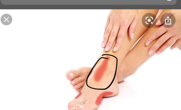 Fussschmerzen Plotzlich Gesundheit Und Medizin Orthopadie Fussschmerzen Fussschmerzen Plotzlich Gesundheit Und Medizin Orthopadie Fussschmerzen